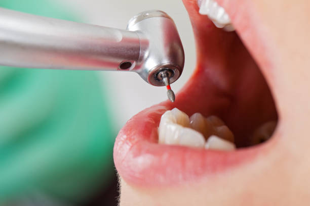 Best Emergency Gum Pain Relief  in Reed City, MI